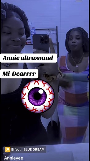 CHILLZ (@1thechosenone5)’s video of ultrasound screaming