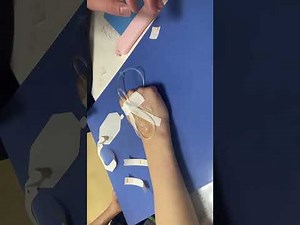 小児の点滴の固定方法