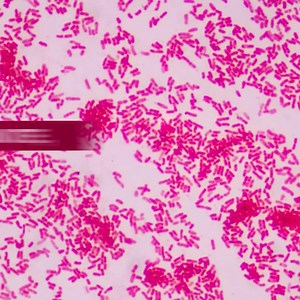 Watch as Dr. Cameron Mantor, chief medical officer at The Children’s Hospital, demonstrates proper hand-washing techniques. | OU Health