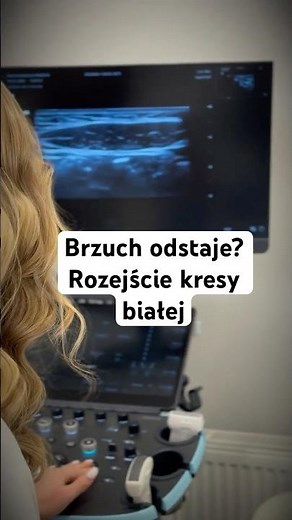 Brzuch odstaje? Rozejście kresy białej #diagnostyka #rozejściekresybiałej #brzuchpociąży #polog