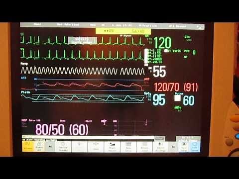 (MP70) Demo -Adult, Neonatal