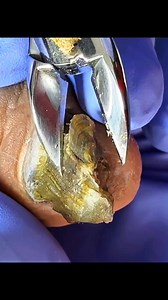 Pedicure the toenails clean | RoBi Bro's