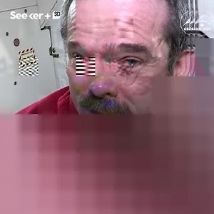 1.7M views · 1.8K shares | Astronauts are returning to Earth with vision problems — here's how space travel could make you go blind. (via Canadian Space Agency) | Seeker by The Verge | Facebook