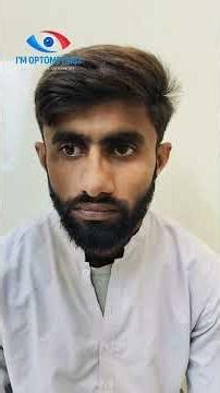 Orthoptics Case #5|EOM Full OU |OD Exotropia ē good fixation | #optometry #ophthalmology #ytshorts