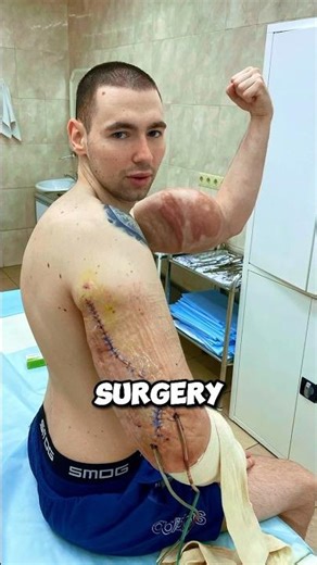 🚨Shocking🚨His Fake Muscles Exploded😱#shorts #bodybuilding #fitness
