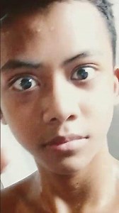 It's fake, her other hand is zooming and her another hand was pretending to be zooming