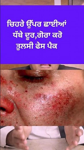 ਚਿਹਰੇ ਨੂੰ ਸਾਫ ਕਰੋ ਛਾਈਆਂ ਧੱਬੇ ਦੂਰ ਕਰੋ ਤੁਲਸੀ ਫੇਸ ਪੈਕ ਨਾਲ