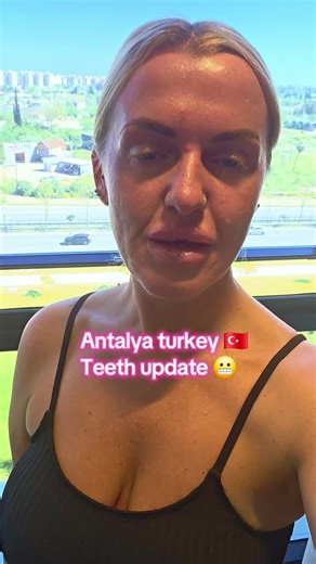Antalya Dental Update: Fingers Crossed!