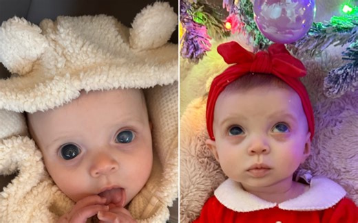 Baby Girl Born With Most Beautiful Eyes, Then Came ‘Terrifying’ Diagnosis