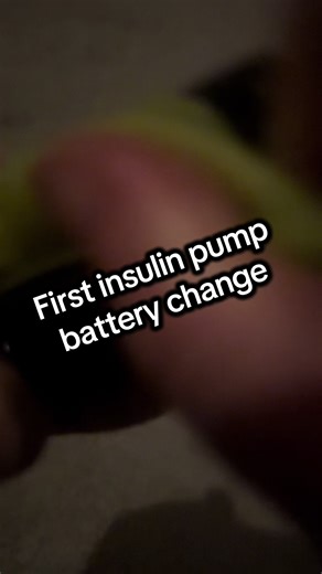 First Battery Change for My Insulin Pump