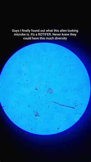 Finally finding out what this mystery microbe is using a microscope 🔬