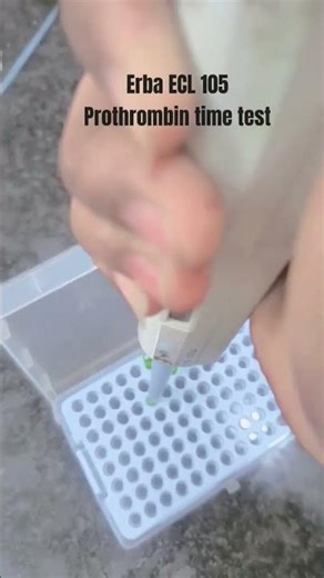 PT INR test and APTT