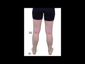 Dermatomes Screen - Lower Extremities