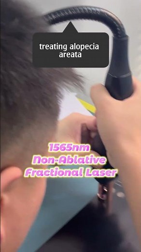 co2 laser machine for skin