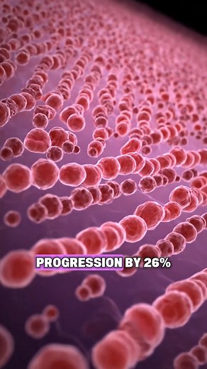 Worried about your macular degeneration getting worse?  EverVision's...