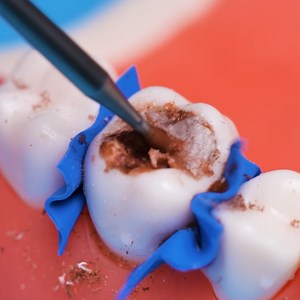 1M views · 2.6K reactions | Dentist Gloves View What Patients Feel | 5-Minute Crafts Play | Facebook