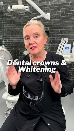 😁 How to get a perfect color match for your dental crown! For a flawless, natural smile, whiten your teeth first and wait two weeks for the color to stabilize before placing your crown. ✨ This ensures your crown blends perfectly with your teeth! 😁 Follow us for more expert dental tips! 😉 #NaturalOralCare #DentalServices #DentalCosmetics | Natural and Cosmetic Dentistry