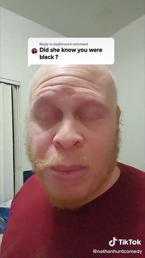 Albino Black Guy Comedy and Jokes | Laugh with Famous Comedian