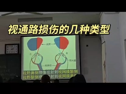 视通路损伤的几种类型