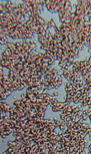What you are seeing is microfilaria - the larval stage of heartworm....