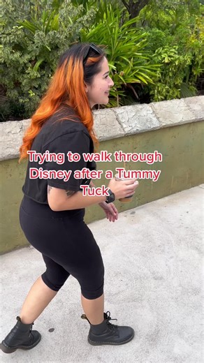 Tummy Tuck Journey: From Weight Loss to Recovery