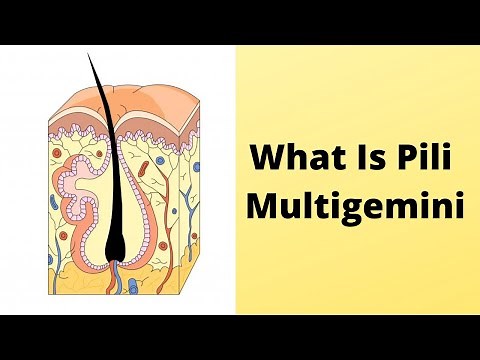 What Is Pili Multigemini