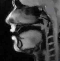9.6K views · 192 reactions | MRI scan showing what happens inside our mouth when we speak. Have you ever got the chance to see this? | Dr.Weird | Facebook