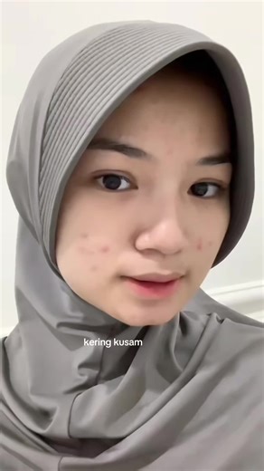 yang punya masalah kulit kaya aku, conain dehh #gloowbe