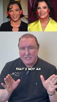 Kris Jenners Facelift