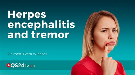 Herpes encephalitis and tremor | Dr. med. Petra Wiechel | Visite
