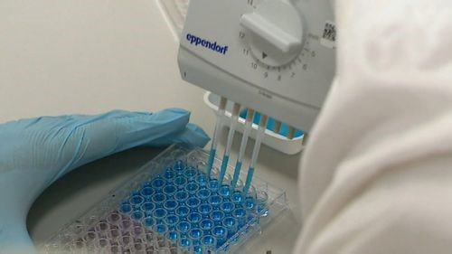 Queensland researchers developing screening test for ovarian cancer