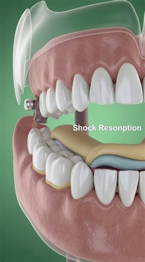 Your Teeth Are Stronger Than Bone | 3D Dental & Medical Visualization