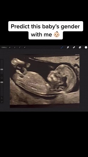Gender Prediction: Nub Theory Explained | Baby Scan Gender Reveal