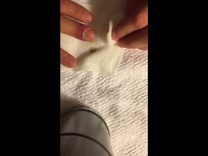 Infected Finger - Incise & Drain (GRAPHIC)