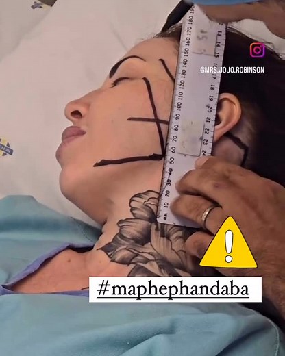 Maphepha Ndaba on Instagram: "[WATCH] Brand New Face For Reality TV Star @mrs.jojo.robinson Jojo, recently went under the knife again. The reality TV star is about to launch and reveal her new face soon, and those in the know, says she might throw by invite only exclusive party to celebrate her newly purchased, or rather expensive face soon, at her expensive newly renovated mansion, that cost her few millions. Trigger Warning ⚠️ Comment Below ⬇️ Only #sensitive #sensitivecontent #triggerwarning 