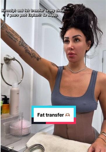 I did a thing. Seven years post removing my implants I decided to do fat transfer with. @AirSculpt The surgery was perfect for me because it’s done while you were completely awake. #fattransfer #explant #explanted #airsculpt