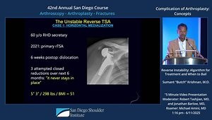 The Unstable Reverse TSA: What to Do and How to Do It