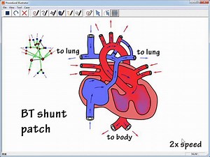Sketch-based Dynamic Illustration of Fluid Systems