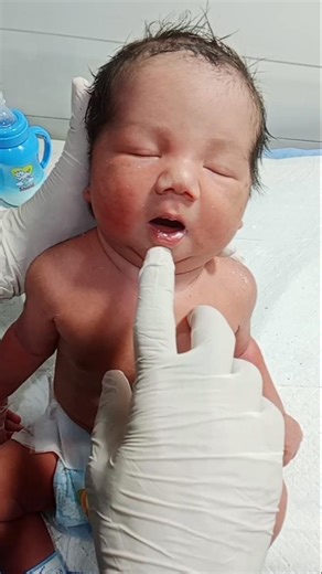 Cute Newborn Little Baby in NICU Observation Care | Good Reflex Moments