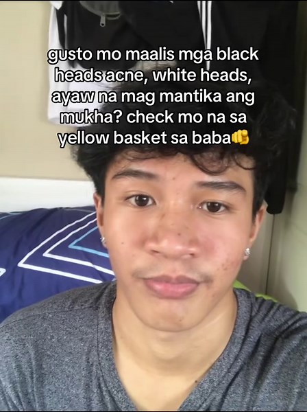 Effective Green Mask Stick for Acne and Blackhead Removal