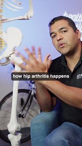 24K views · 205 reactions | The REAL reason people get hip arthritis...