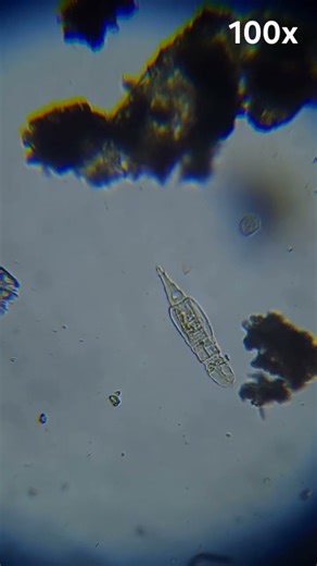A Rotifer in Full Motion Under the Microscpe (100x)