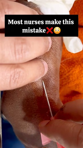 Mistakes during iv Cannulation #iv#mbbs#nurse#trending