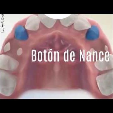 Boton de Nance