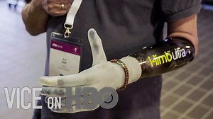 How Bionic Limbs Are Changing Lives | VICE on HBO – Lifeboat News: The Blog