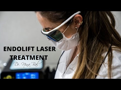 Endolift Laser Treatment with Dr Nina Bal 💕 Endo Lifting Laser Face Lift Treatment