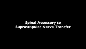 Nerve Transfers for C5 C6 Brachial Plexus Palsy