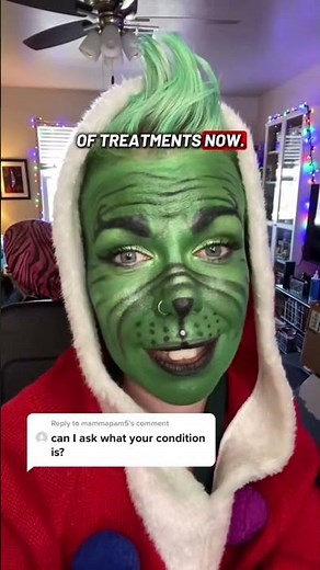 Spinal muscular atrophy type two ￼