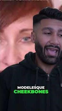 How I Fixed My Low Cheekbones 💉😳