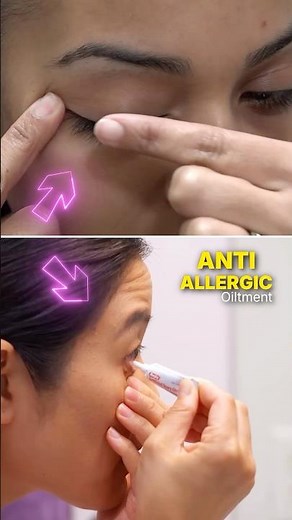 Correct Way to Apply Eye Ointment | Avoid Infection & Damage
